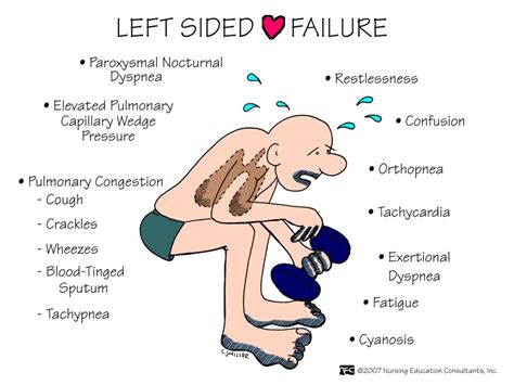 signs and symptoms of left sided heart failure